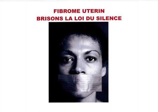 fibrome-uterin-silence